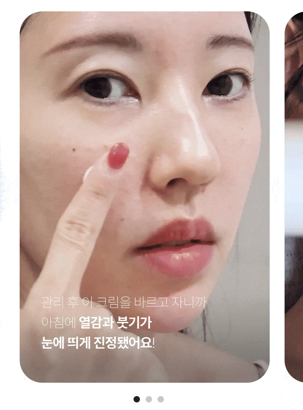 [1등 크림/손상장벽 애프터케어] 센텔리안24 마데카 크림 PDRN 기획세트 50ml+15ml 상세페이지 11